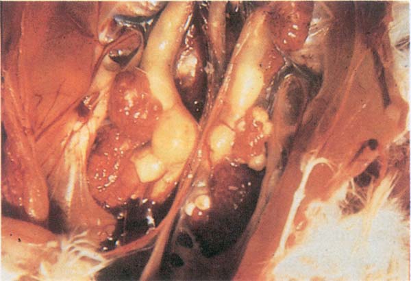 Chicken w Beak Cut off - Chicken Flesh w/Uric Acid Crysals